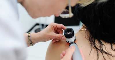 Hätkähdyttävä tutkimustulos – yli puolella keski-ikäisistä hoitoa vaativa ihosairaus